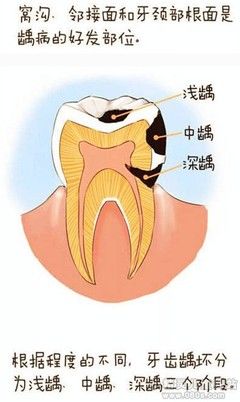 梦见掉牙齿又长出新牙是什么征兆：梦到掉牙又生新牙是神马预兆