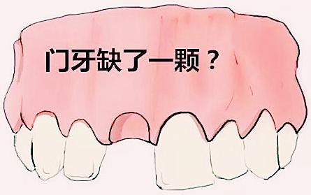 梦到牙齿松动一拔就掉：