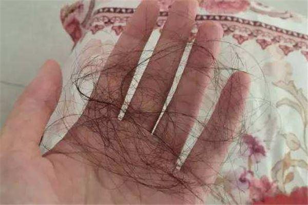 女人梦见掉了一坨头发：女人梦见掉头发怎么化解