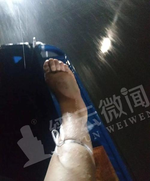 做梦被蛇咬到腿意味着什么意思：做梦被蛇咬小腿