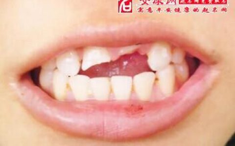 梦见牙掉了一颗没流血,梦见自己牙齿掉了没有出血是什么意思