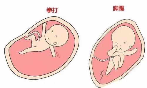 梦见自己怀孕还有胎动意味着什么?
