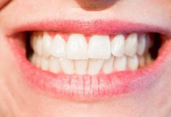 女人梦见掉了两颗牙什么预兆上牙