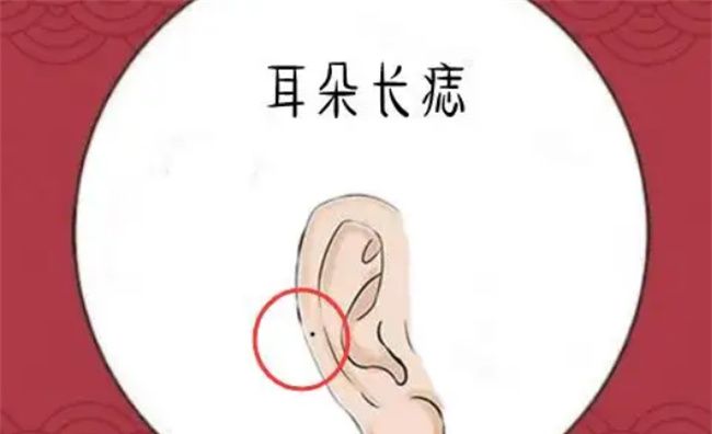 最有福气的痣长在哪里图1