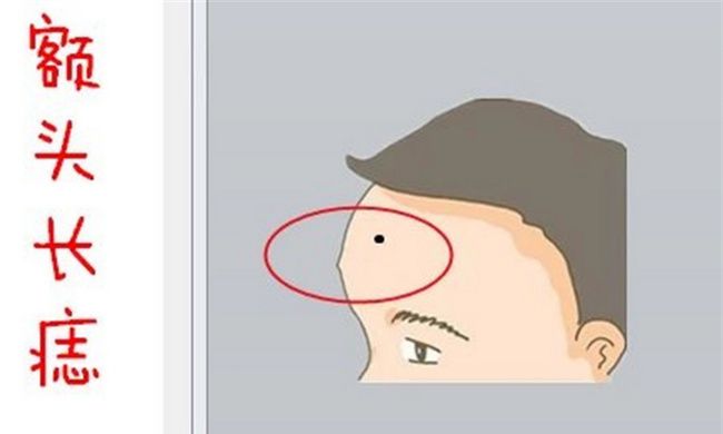 痣长在脸上哪个部位不好图1