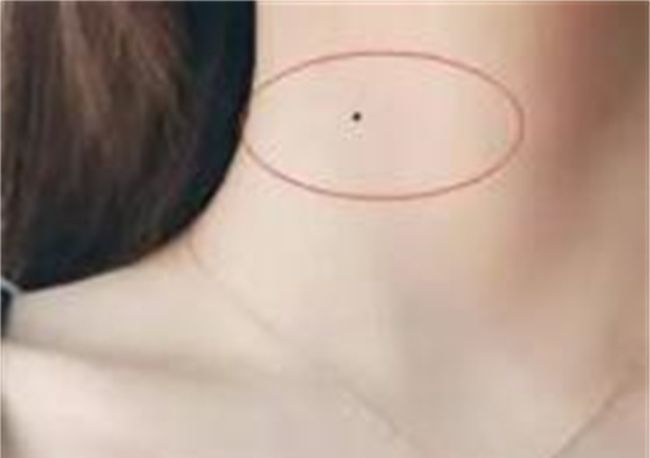 脖子有痣的女人代表什么图1