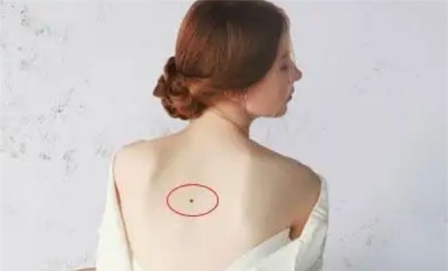 背上长痣的代表含义 有什么图1