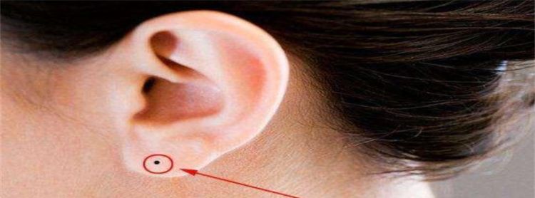 女人耳朵长痣面相图解耳内有痣图1