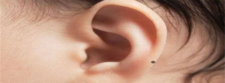 女人耳朵长痣面相图解耳内有痣图2