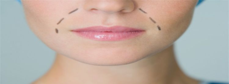 容易长法令纹的脸型，到底为什么会有法令纹因为皮肤老化下垂图1