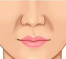 容易长法令纹的脸型，到底为什么会有法令纹因为皮肤老化下垂图4