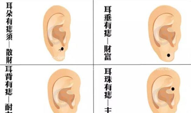 耳朵哪个地方长痣好 侧脸靠近耳朵附近有痣好图3