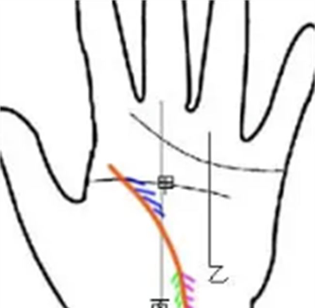 不同生命线的看法根据形态判断图3