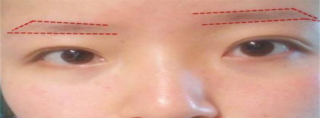 眉毛看相：高低眉的人代表着什么左眉高右眉低图1