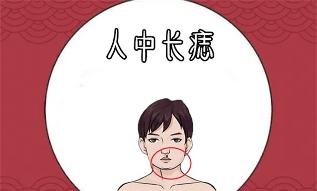 男人苦命痣长在哪里图2