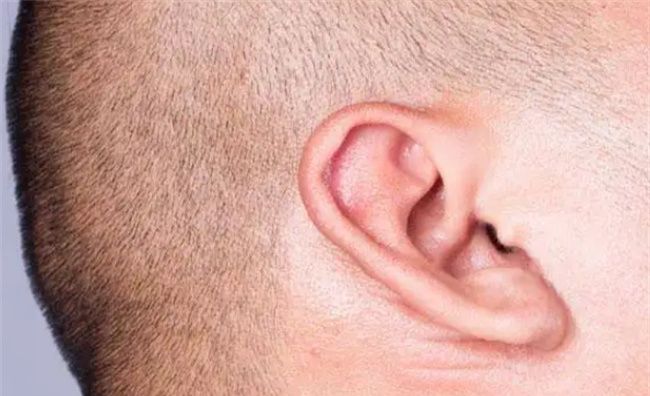 男人耳朵小代表什么意思图3