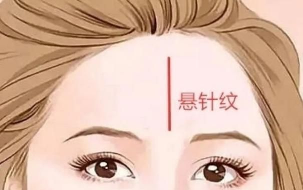 女人悬针纹怎么变福针纹图2