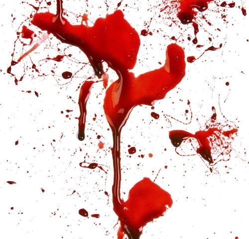 梦到杀人见血是什么意思