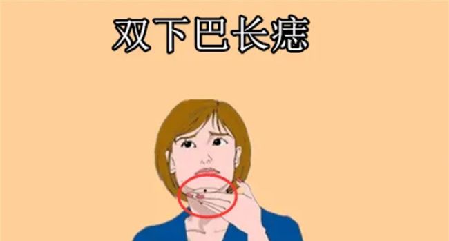 女人脸上哪些痣不能动图1