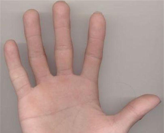 女人手掌纹路图解右手断掌纹 个性执着重事业图2
