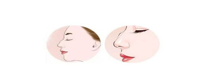 不利于婚姻的鼻子有哪几种起节鼻图1