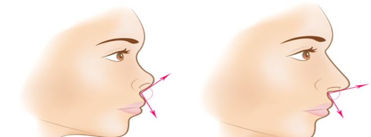 不利于婚姻的鼻子有哪几种起节鼻图3