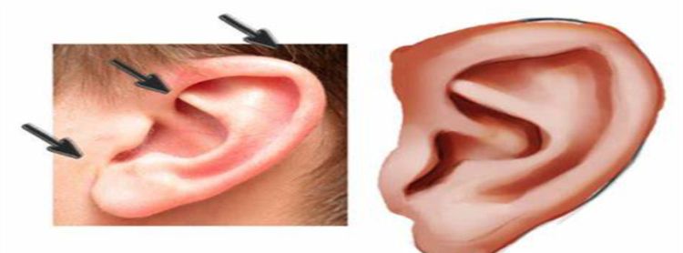 脸大耳朵小的男人性格特点，解析耳朵与人的性格和运势不同的耳朵图1