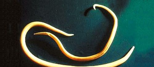 最早出现肛门的动物是　　 A．原生动物 B．腔肠动物 C．扁形动物 D．线形动物