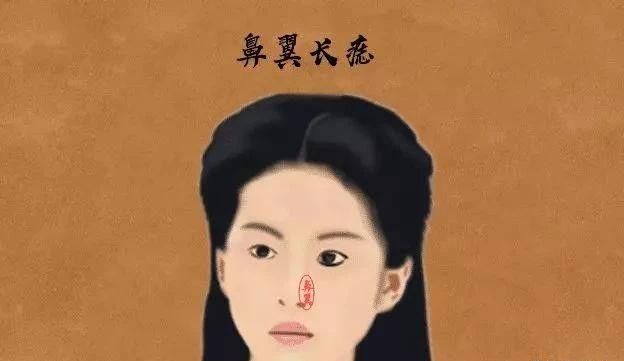 女人身上的10大福痣 脸上