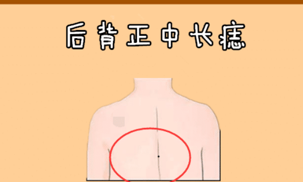 女人背部有痣好不好,女人背后有痣代表什么 好不好图4