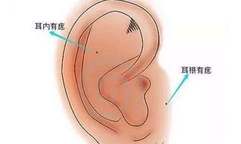 耳朵有痣代表什么意思