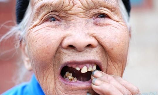 女人梦见牙齿掉了好几颗是什么意思