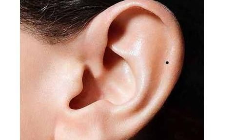 耳朵周围有痣的女人代表什么