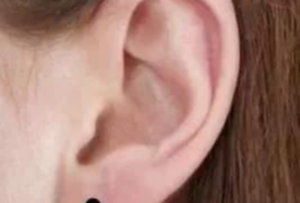 耳朵哪个地方长痣好 侧脸靠近耳朵附近有痣好,耳朵周围有痣的女人代表什么图7