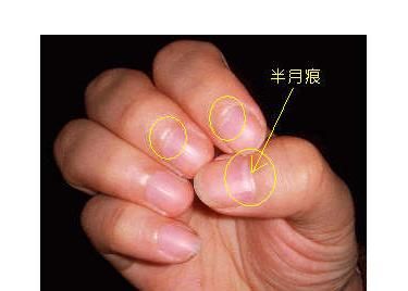 指甲半月痕有什么特别的含义 代表健康