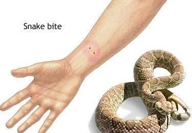 梦见蛇咬手指头的预兆是什么