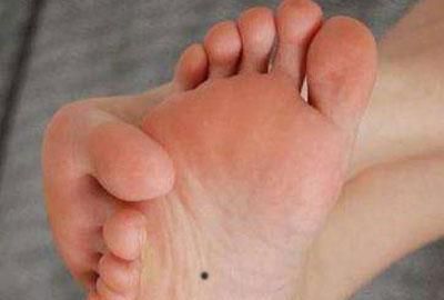 男人脚底有痣代表什么含义对命运有何影响呢