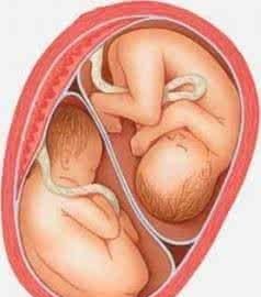 孕妇梦见双胞胎男孩是什么意思